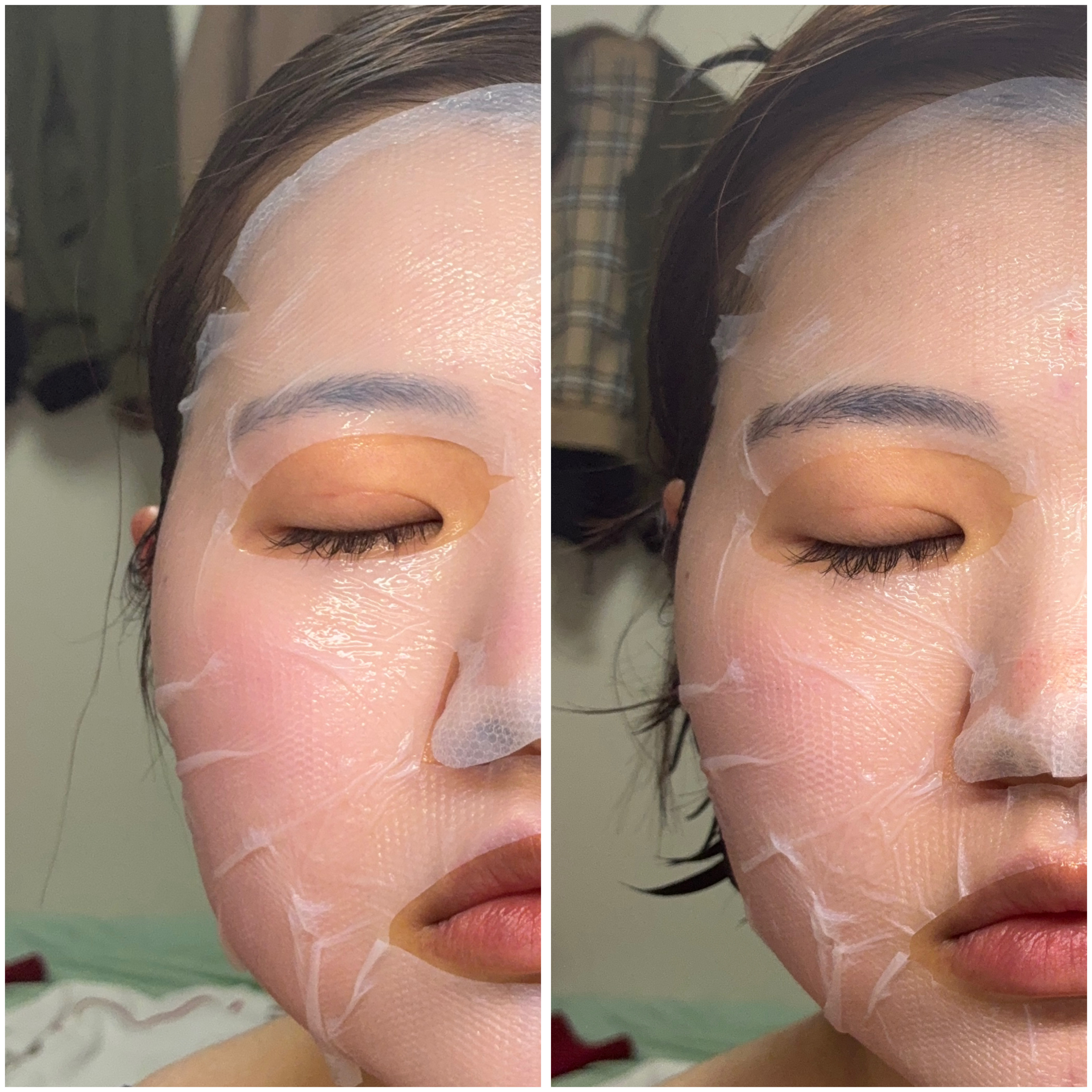 トラブルパッチマスク/EIOM/その他スキンケアを使ったクチコミ（3枚目）