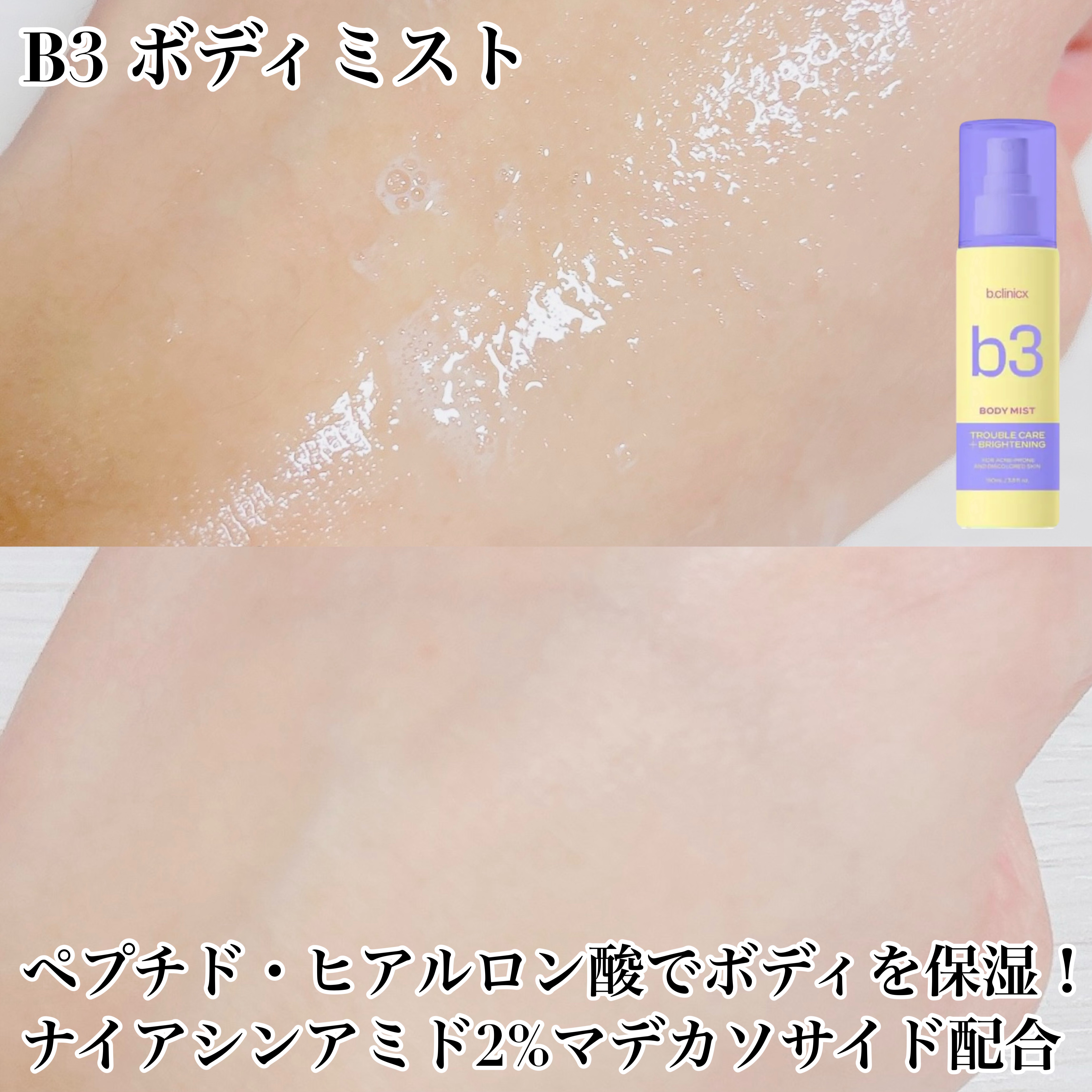 b3 2% ボディミスト/b.clinicx/ボディローションを使ったクチコミ（3枚目）
