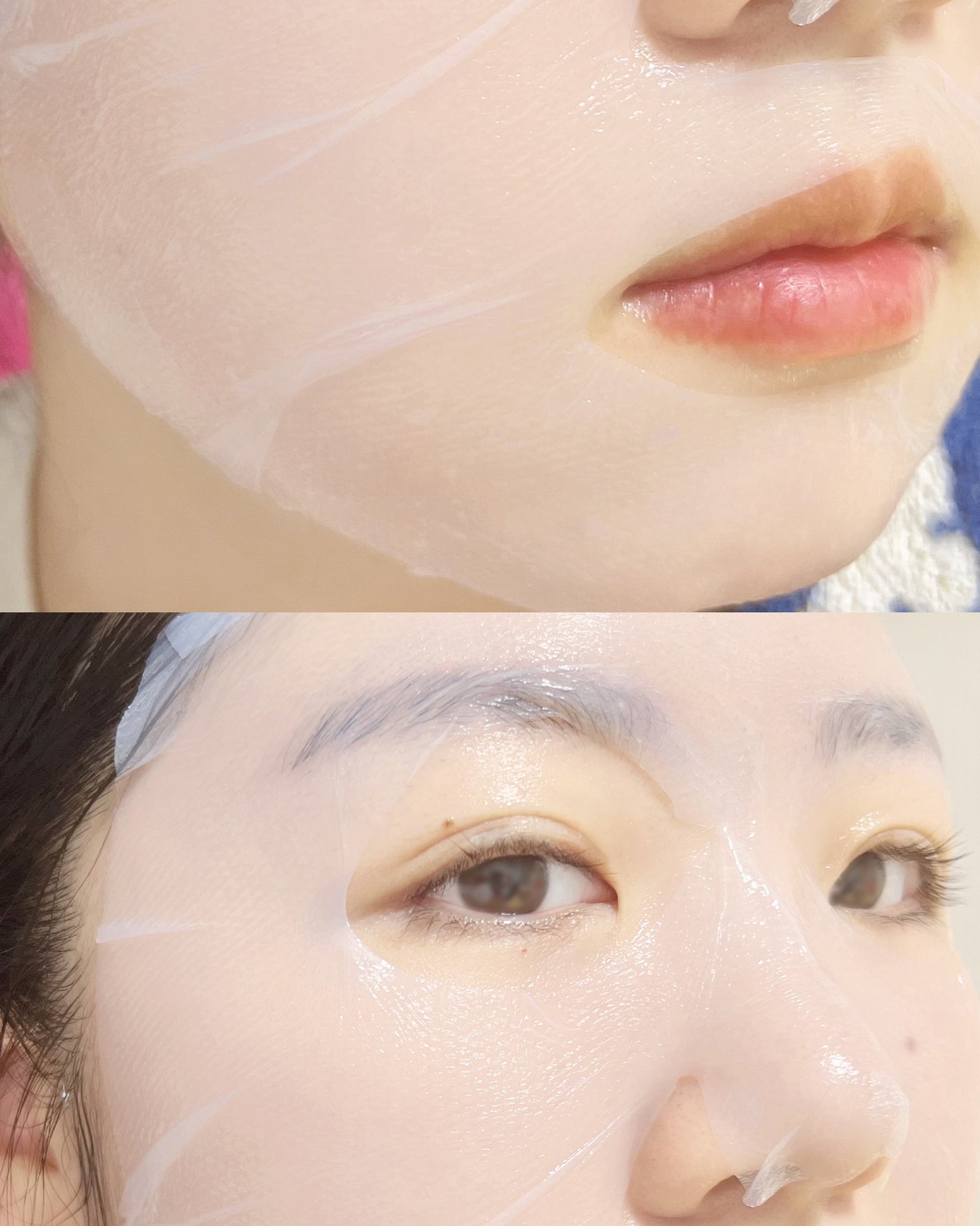 トラブルパッチマスク/EIOM/その他スキンケアを使ったクチコミ(3枚目)