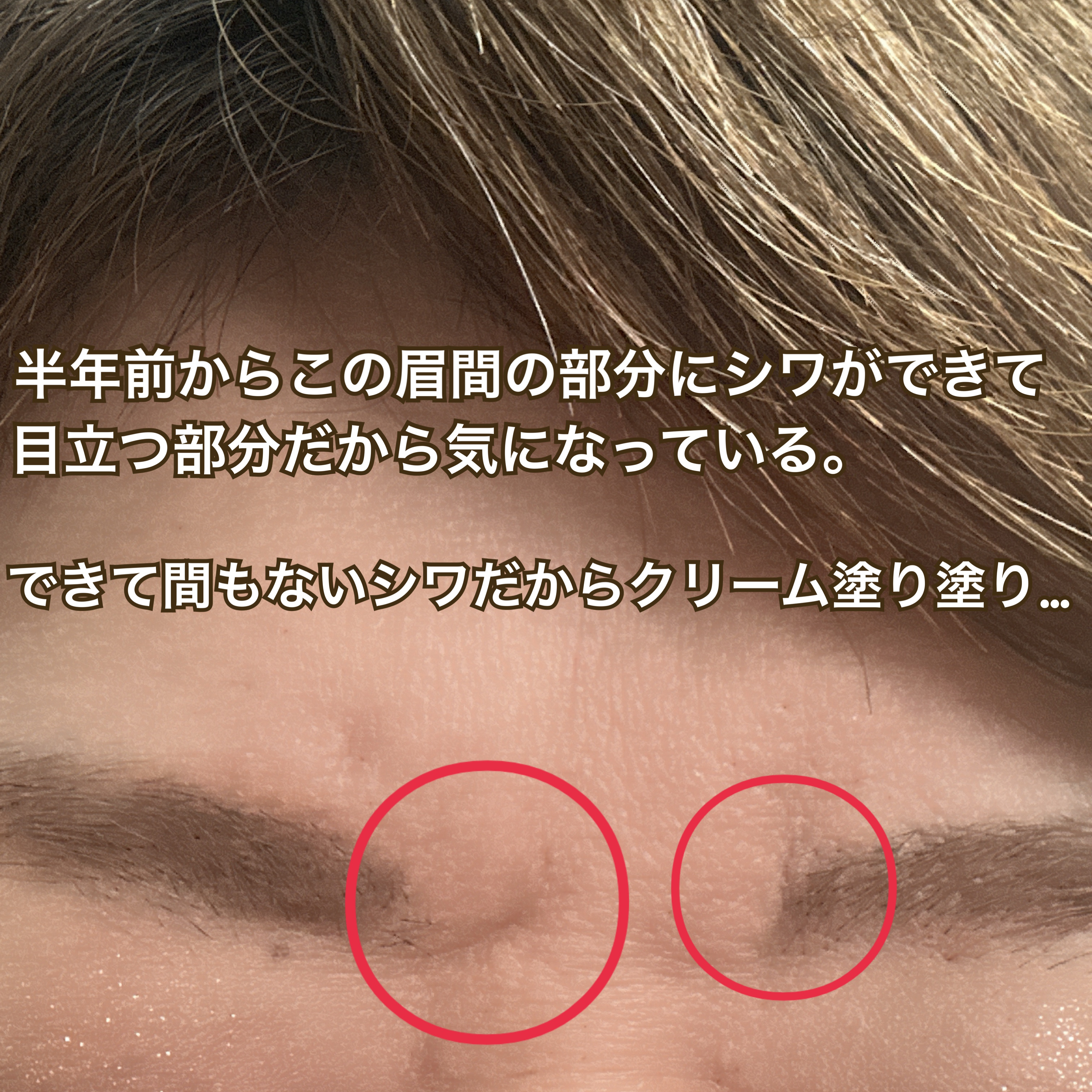 レチノパワー リンクルクリーム /エリクシール/アイケア・アイクリームを使ったクチコミ（2枚目）