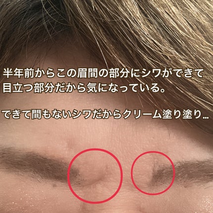 レチノパワー リンクルクリーム /エリクシール/アイケア・アイクリームを使ったクチコミ(2枚目)