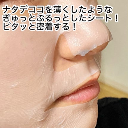 トラブルパッチマスク/EIOM/その他スキンケアを使ったクチコミ(3枚目)