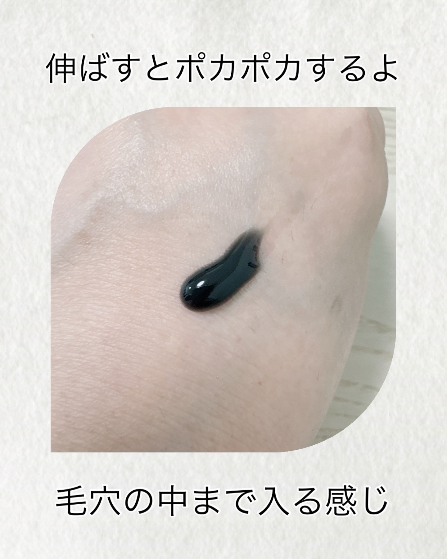 ｓｋｉｍｍｅ　  ヒートブースト　ポアクリア　ジェル洗顔/クラシエ/その他洗顔料を使ったクチコミ（2枚目）