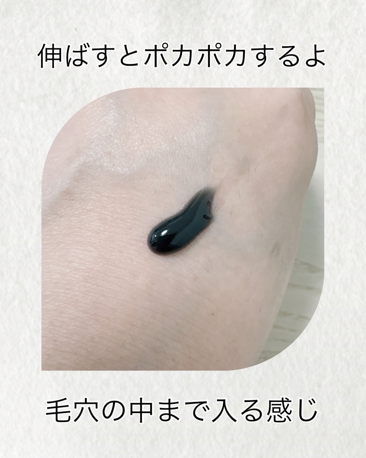 skimme ヒートブースト ポアクリア ジェル洗顔/クラシエ/その他洗顔料を使ったクチコミ(2枚目)