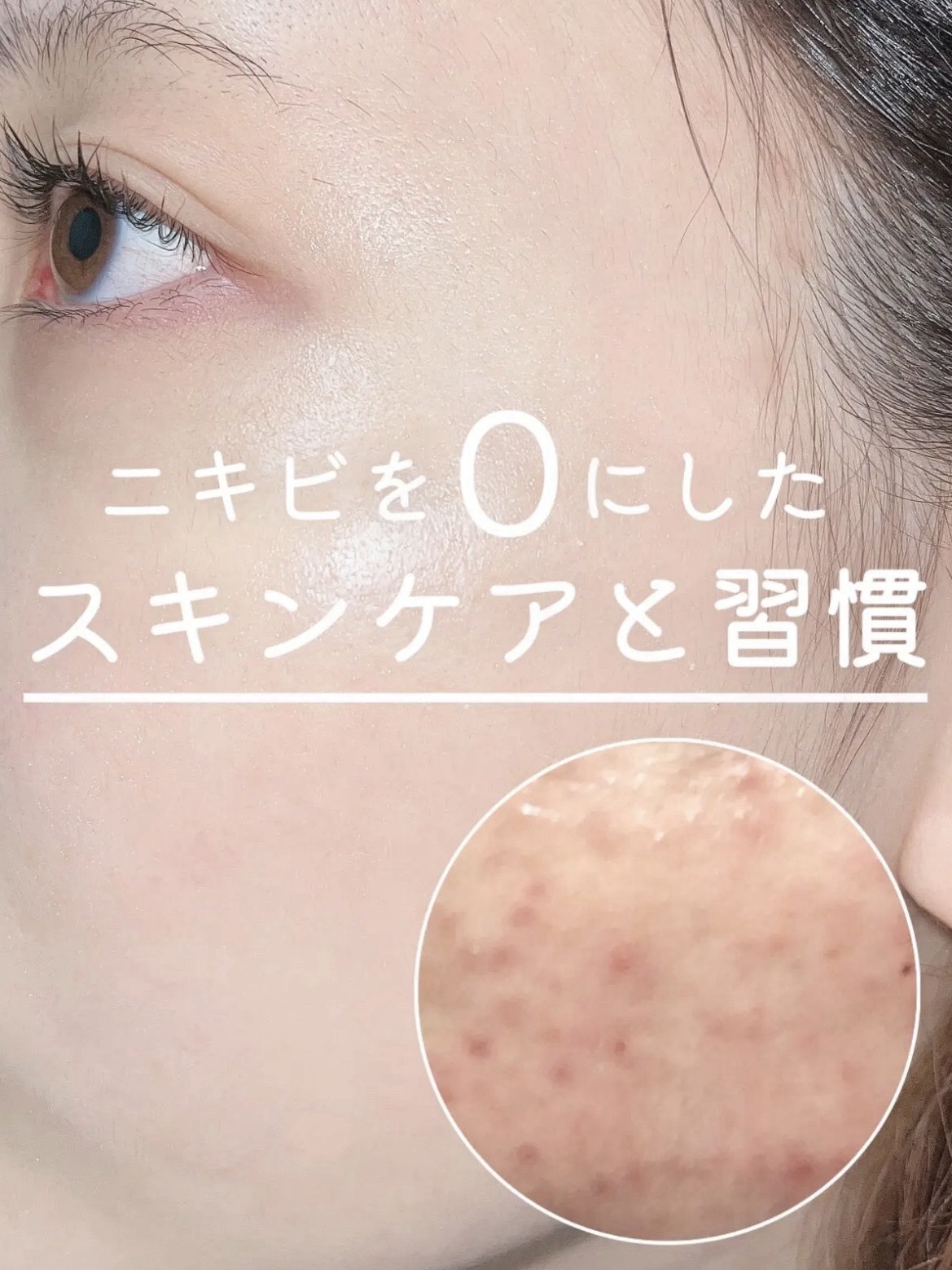 皮脂トラブルケア 化粧水/キュレル/化粧水を使ったクチコミ（1枚目）