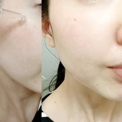 AZアゼライン酸15セラム/コスデバハ/美容液を使ったクチコミ(4枚目)