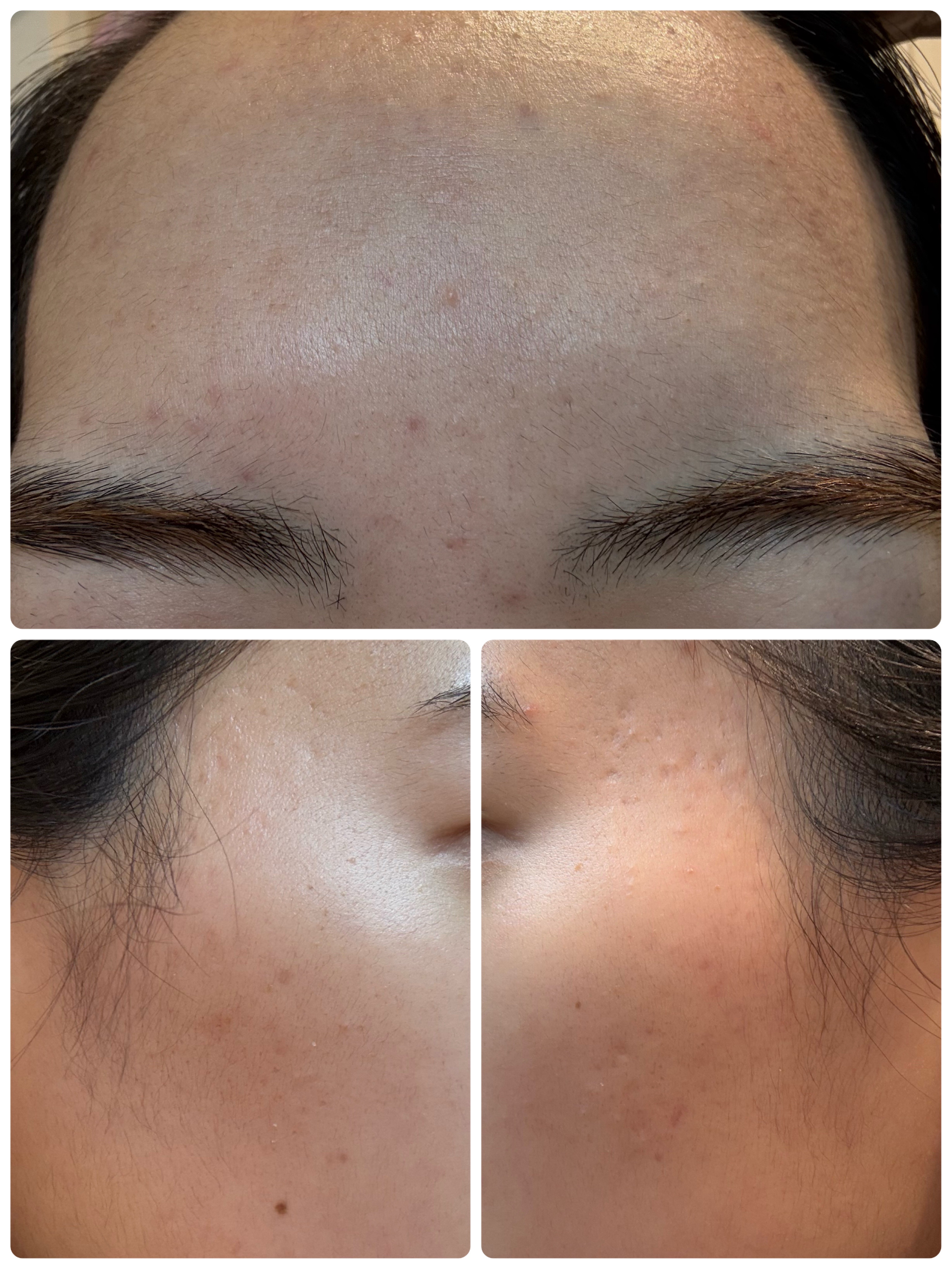 ビタミンC「2000」（医薬品）/武田薬品工業/健康サプリメントを使ったクチコミ（3枚目）