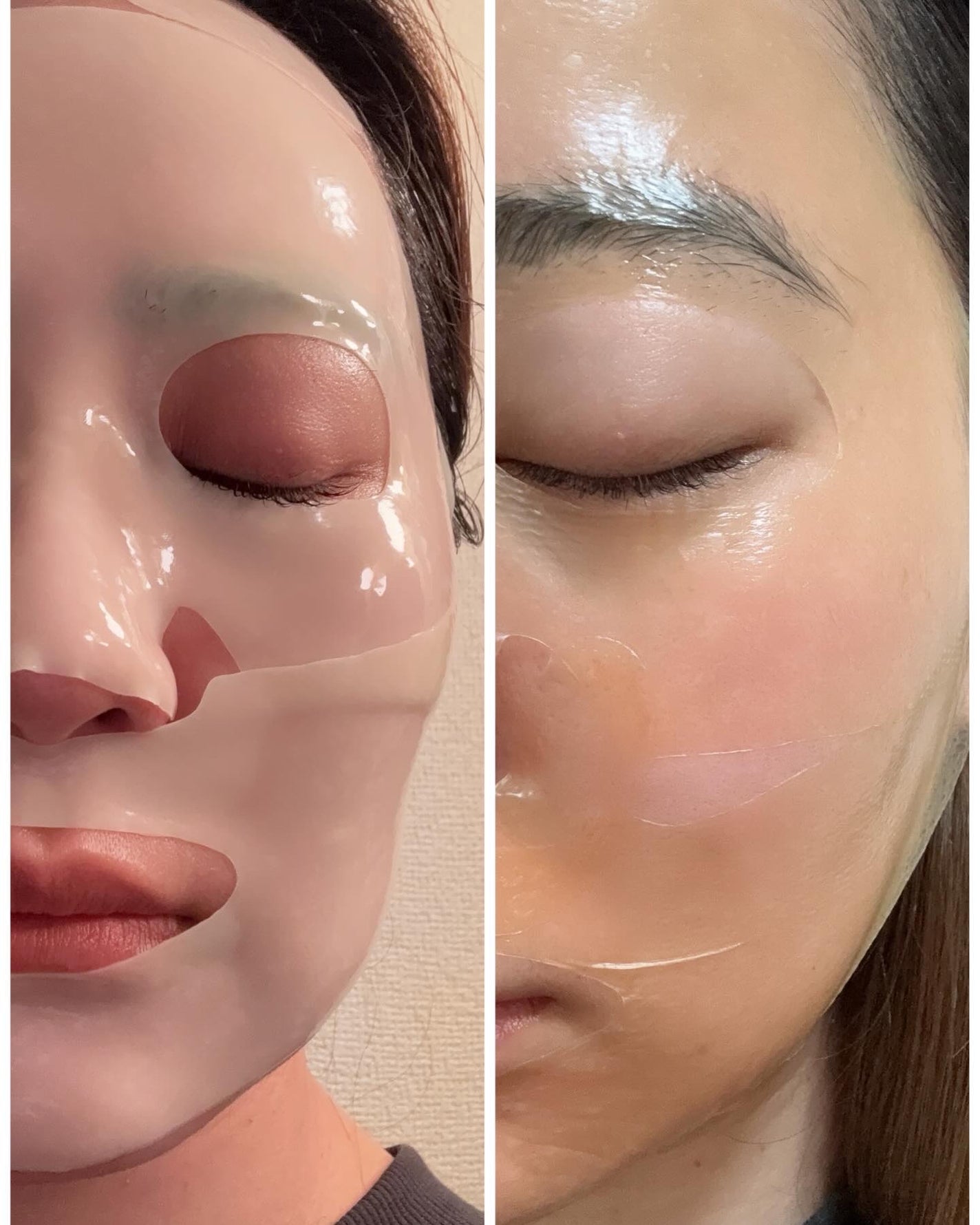 パーフェクト リアル パフォーマンス ビタコラーゲ ンマスクパック /ダーマフィックス/シートマスク・パックを使ったクチコミ(5枚目)