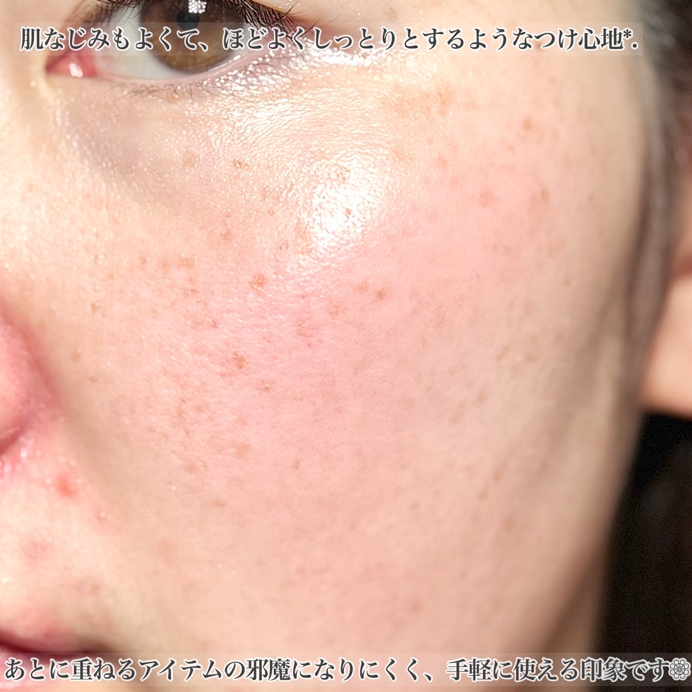 プラチナレーベル VCグルタチオンローション/プラチナレーベル/化粧水を使ったクチコミ(5枚目)