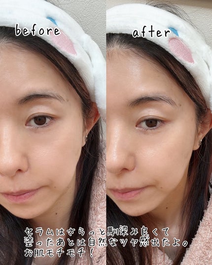 アイソイ 目元集中ケア アイゲルパッチ /ISOI/アイケア・アイクリームを使ったクチコミ(3枚目)