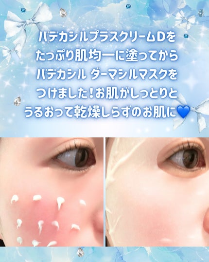 Abo on LIPS 「やっほー❣Aboです🤍✨🌟23yearsold🌟韓国を代表する..」(6枚目)