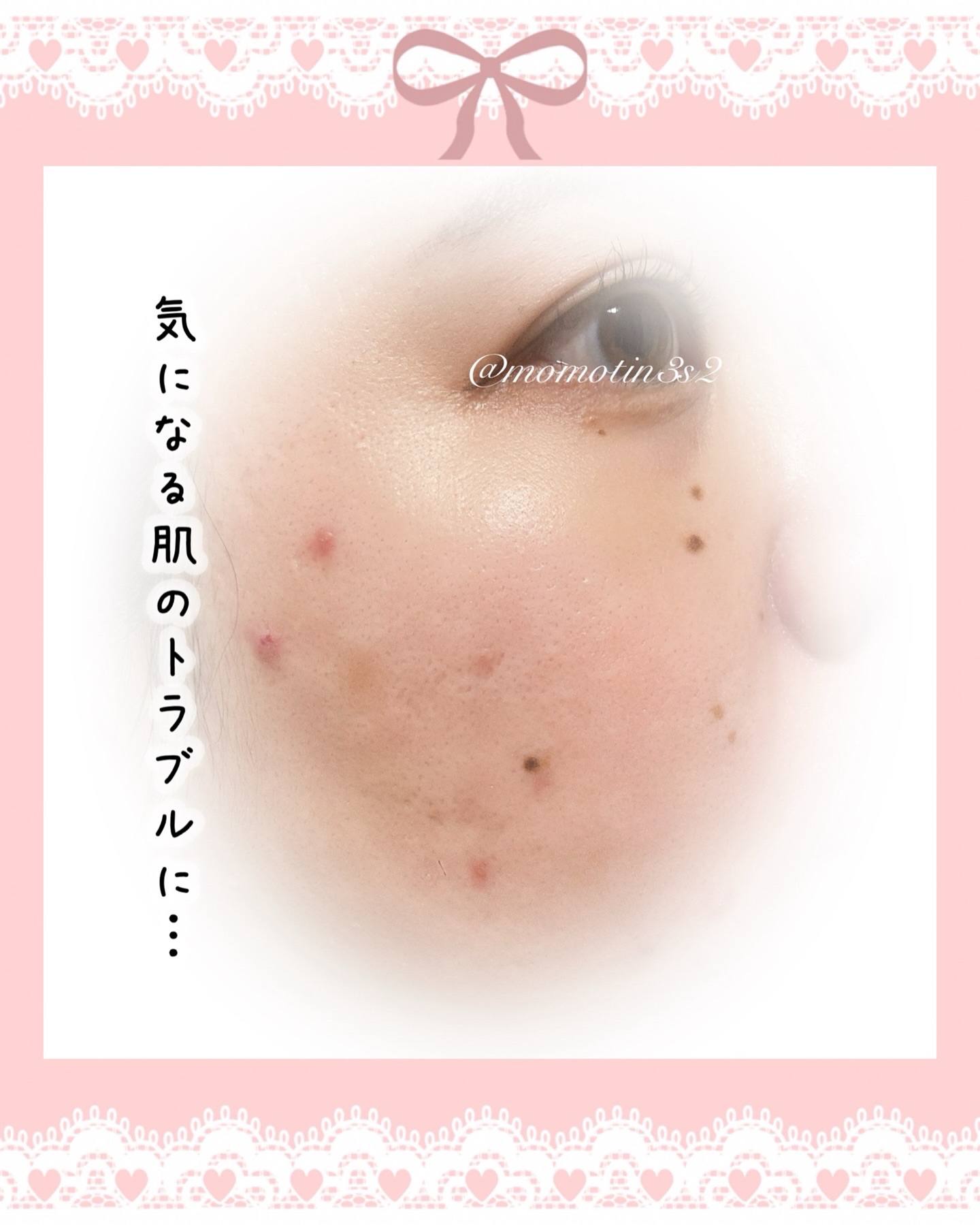 バデカシルDクリーム/23years old/フェイスクリームを使ったクチコミ（2枚目）