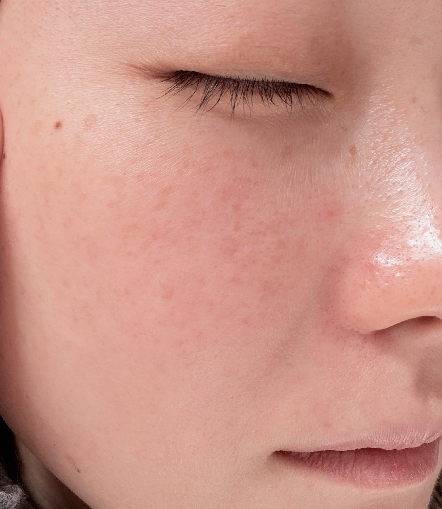 ドクダミクリームカーミングチューブ/Abib /フェイスクリームを使ったクチコミ（1枚目）