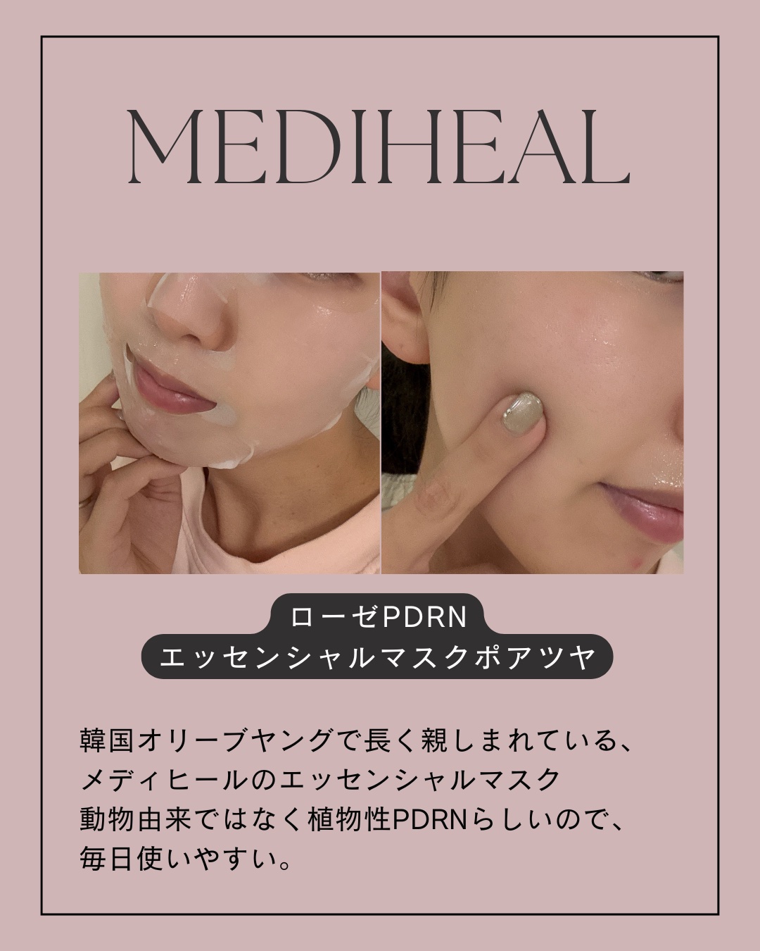 ローゼPDRNエッセンシャルマスクヘルシーグロウ/MEDIHEAL/シートマスク・パックを使ったクチコミ（2枚目）