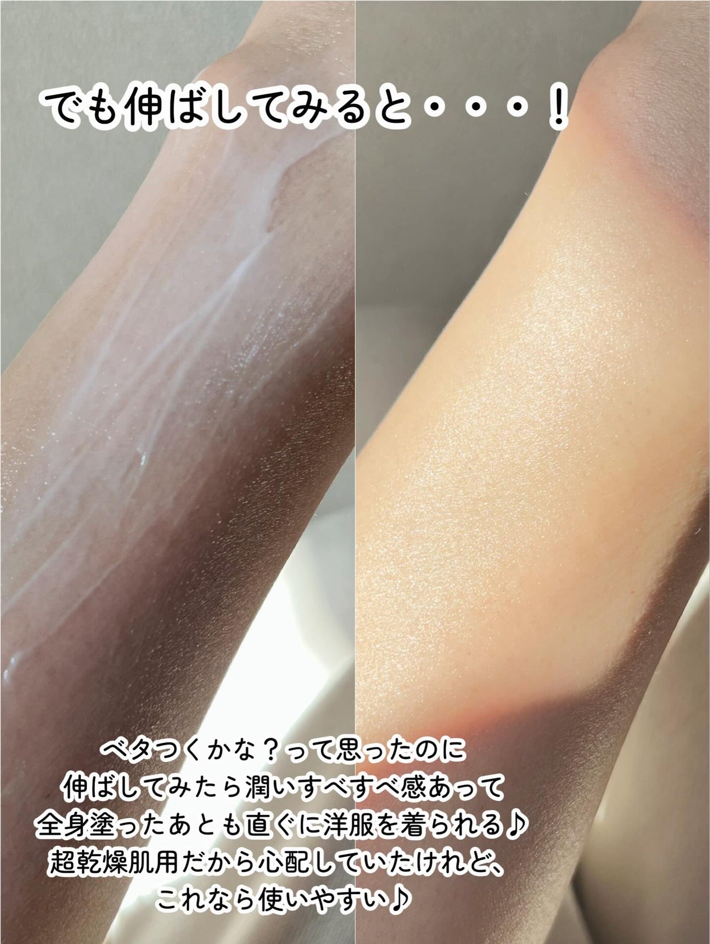 ノルウェー フォーミュラ インテンスリペア CICAボディエマルジョン/Neutrogena/ボディローションを使ったクチコミ(4枚目)