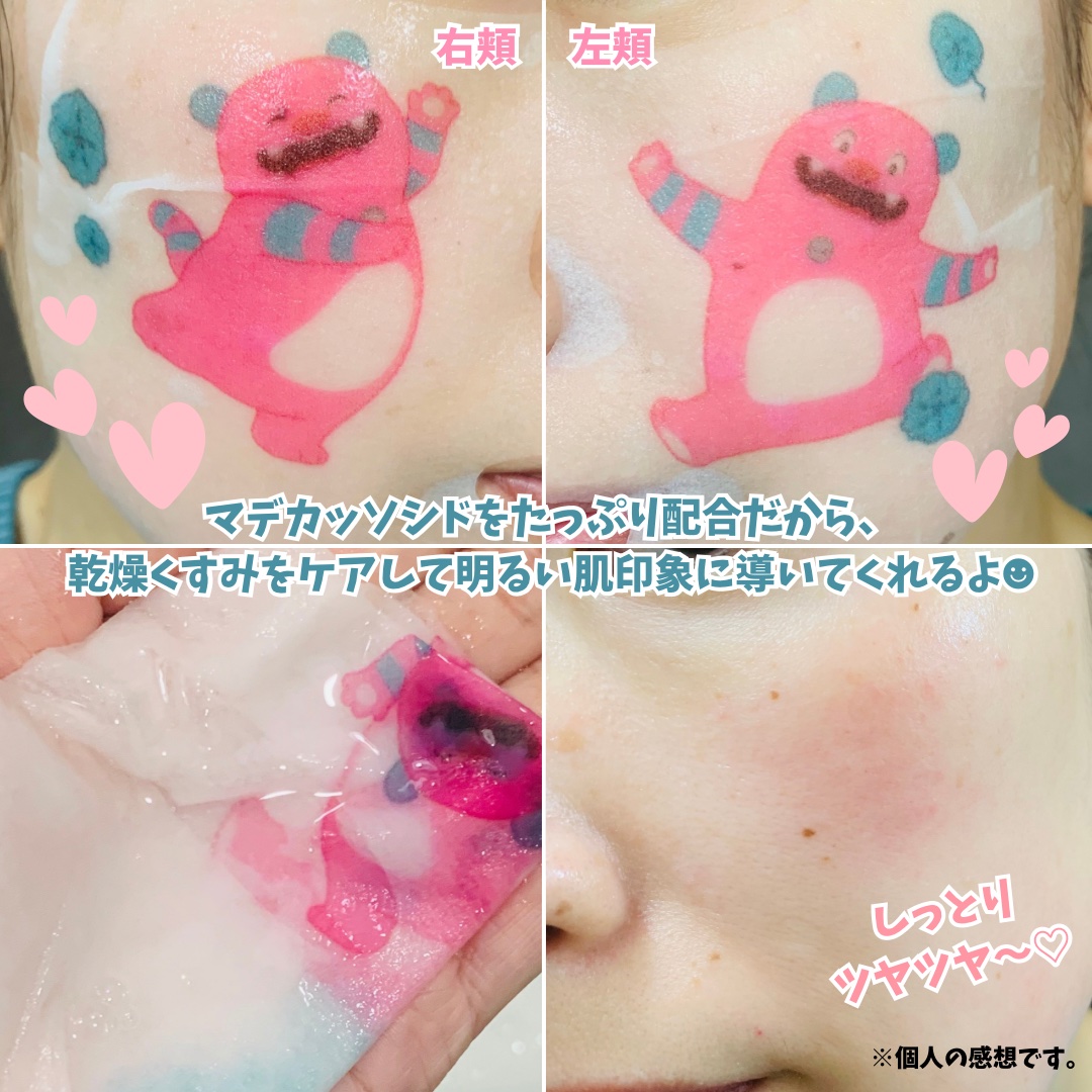 マデカッソシド エッセンシャルマスク/MEDIHEAL/シートマスク・パックを使ったクチコミ（3枚目）