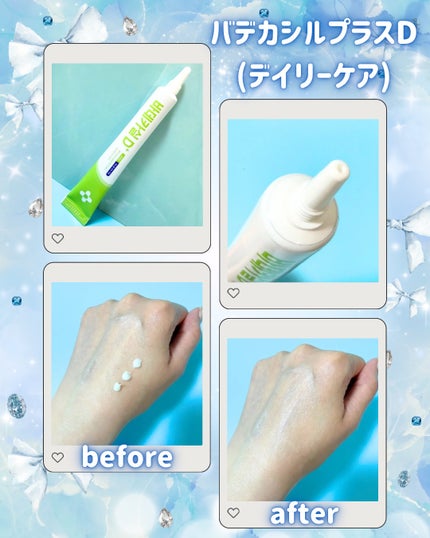 Abo on LIPS 「やっほー❣Aboです🤍✨🌟23yearsold🌟韓国を代表する..」(4枚目)