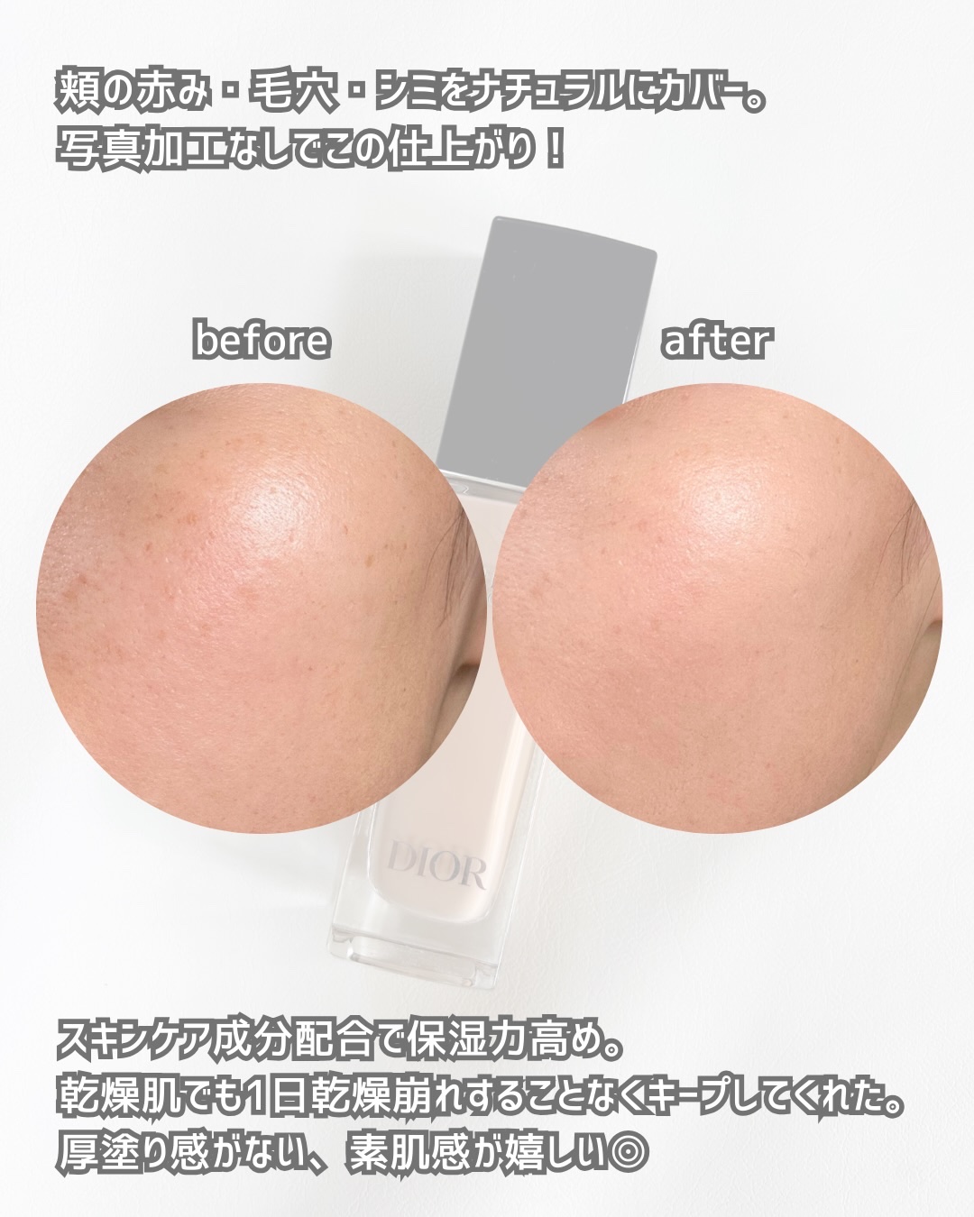 ディオールスキン フォーエヴァー スキン コレクト コンシーラー/Dior/リキッドコンシーラーを使ったクチコミ（3枚目）