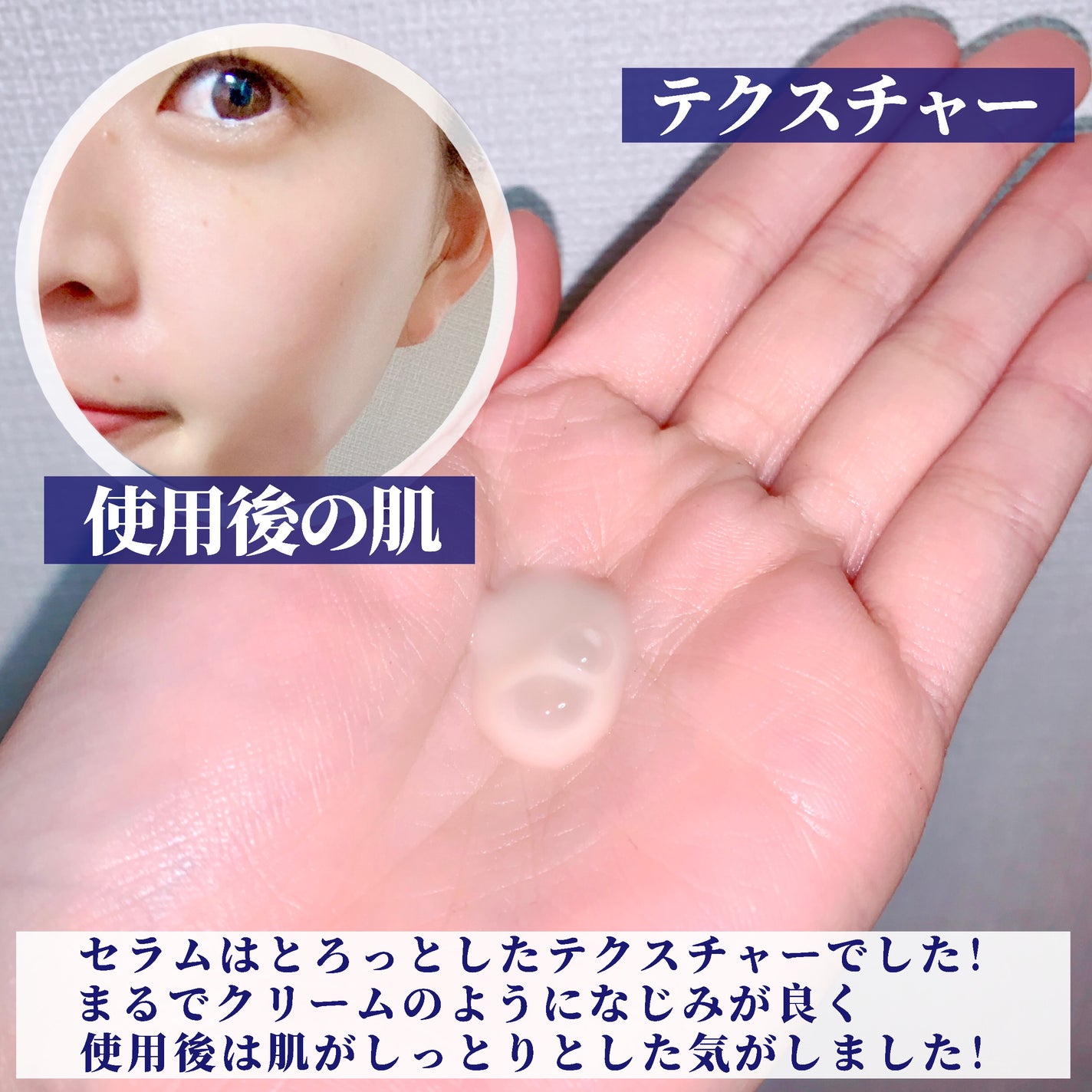 ブラックスネイル クリーム/Dr.G/フェイスクリームを使ったクチコミ(3枚目)