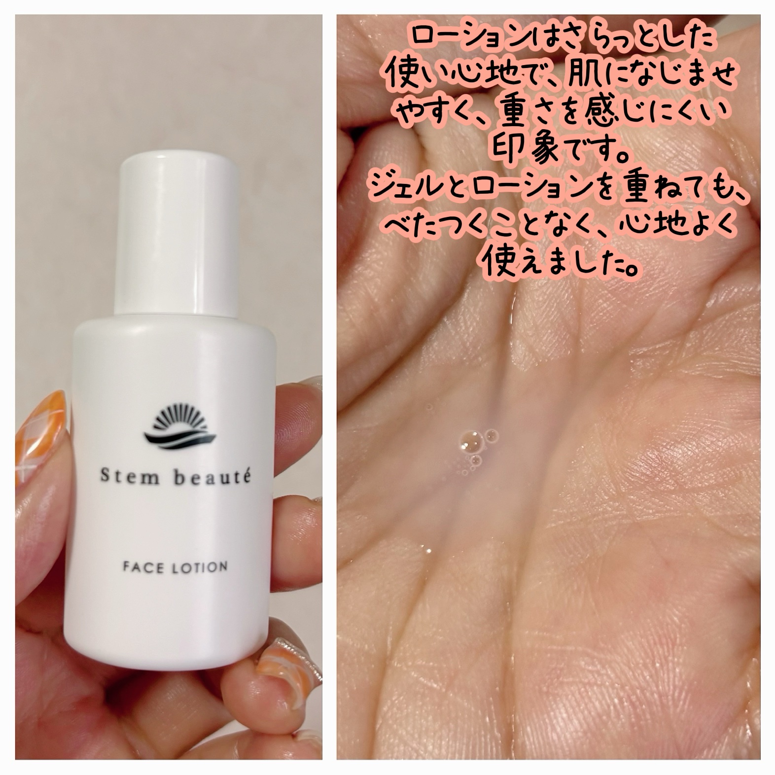 New Trial set/ステムボーテ/トライアルキットを使ったクチコミ（3枚目）