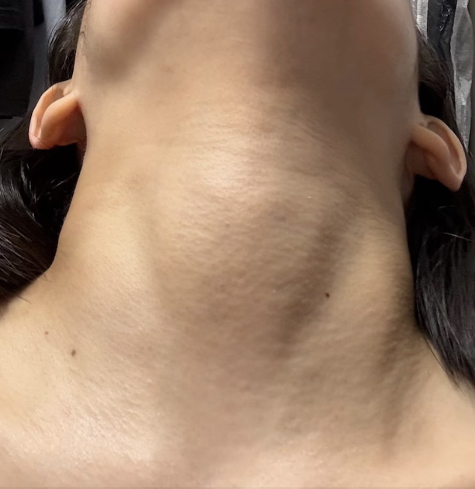 リジュビネイティングネックリンクルコントロールマスク/avajar/ネック・デコルテケアを使ったクチコミ（3枚目）