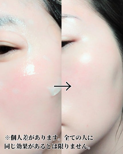 ローゼPDRNエッセンシャルマスクヘルシーグロウ/MEDIHEAL/シートマスク・パックを使ったクチコミ(3枚目)