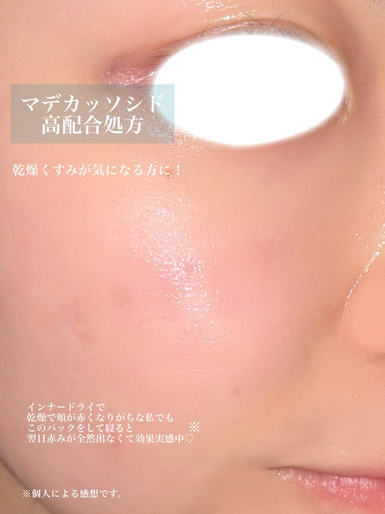 マデカッソシド エッセンシャルマスク/MEDIHEAL/シートマスク・パックを使ったクチコミ（3枚目）