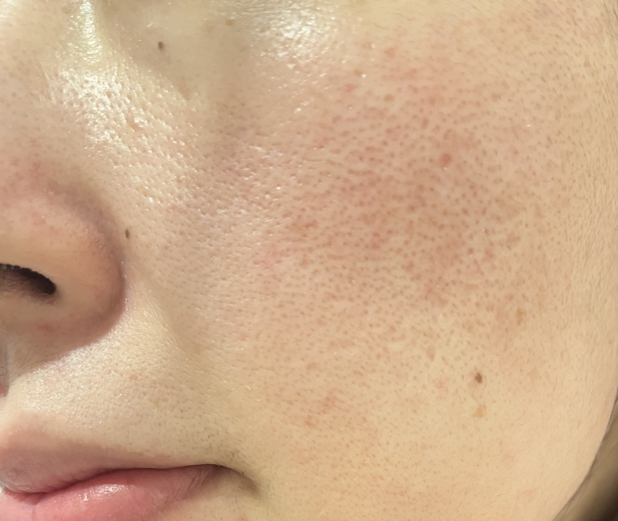 トリプル レチノール ウォッシュピール/Celladix/ピーリングを使ったクチコミ（2枚目）