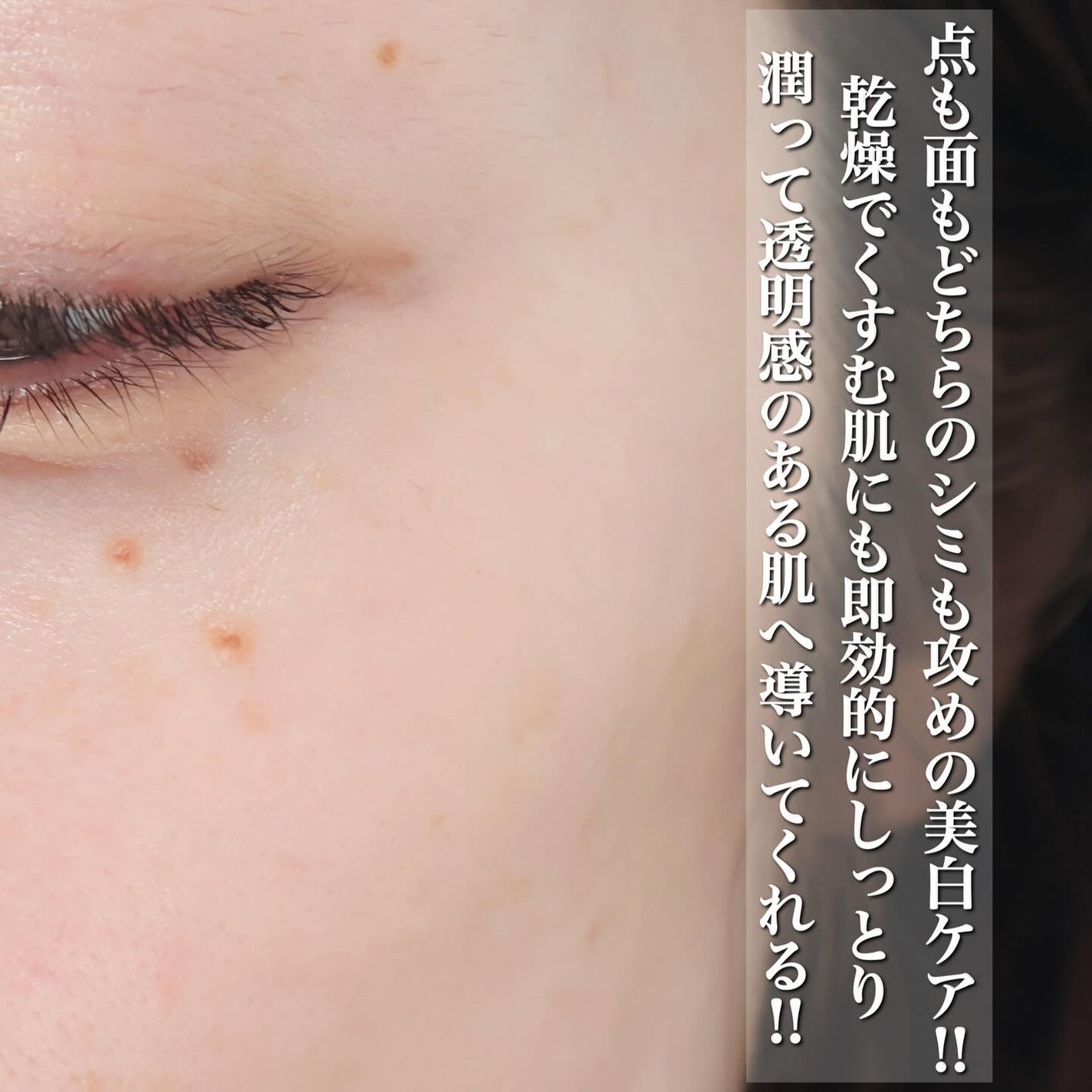 コスメデコルテ ホワイトロジスト クロノジェネシス ブライトニング コンセントレイト 1.8X【医薬部外品】<美白美容液>/DECORTÉ/美容液を使ったクチコミ(4枚目)