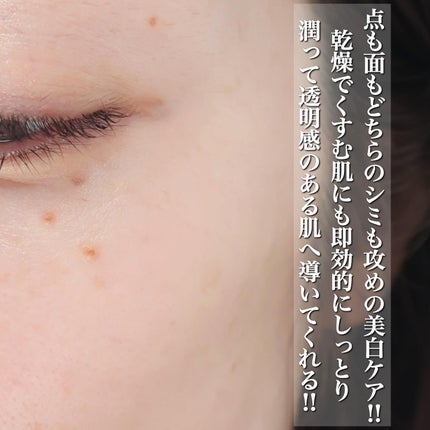 コスメデコルテ ホワイトロジスト クロノジェネシス ブライトニング コンセントレイト 1.8X【医薬部外品】<美白美容液>/DECORTÉ/美容液を使ったクチコミ(4枚目)