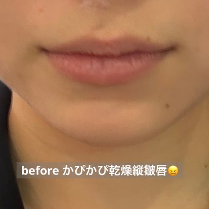 リードルS リッププランパーエキスパート/VT/リッププランパーを使ったクチコミ(5枚目)