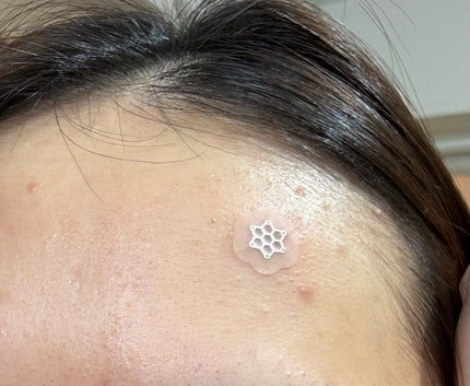 ACマグネシウムパッチ/スノーツープラス/シートマスク・パックを使ったクチコミ(3枚目)