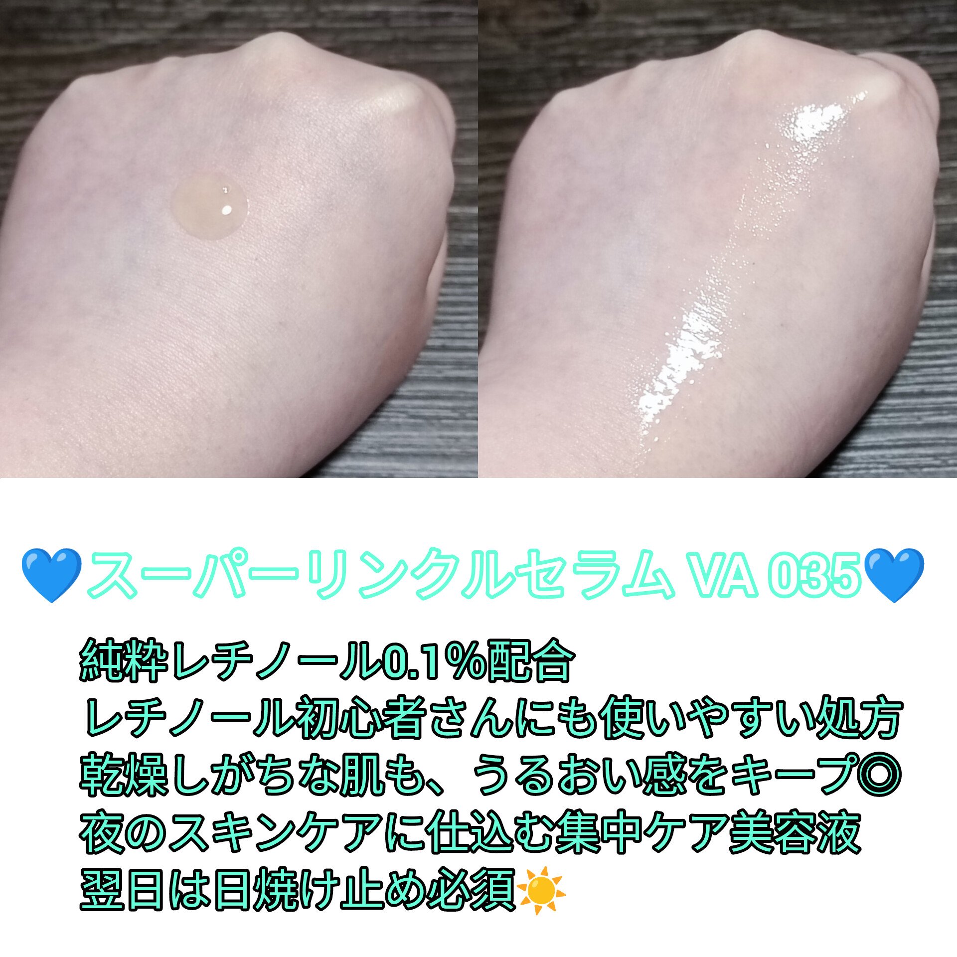 キソ フェイスマスク MADECASSOSIDE　マデカソサイド　＜グリセリンフリー＞/KISO/シートマスク・パックを使ったクチコミ（3枚目）