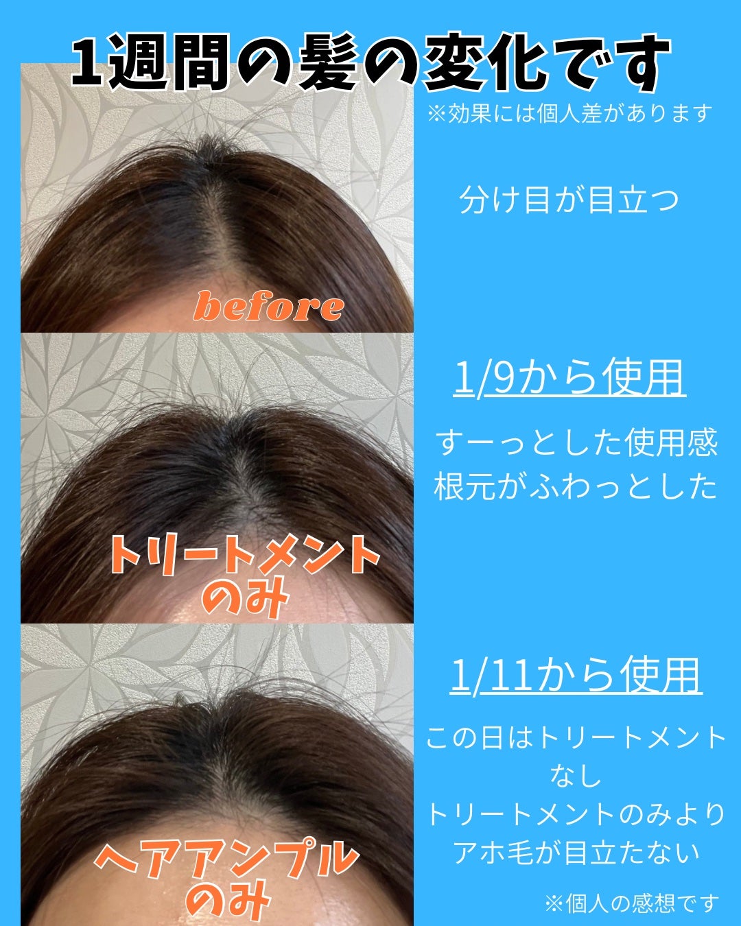 グローターンヘアアンプル/リリーイブ/頭皮ローションを使ったクチコミ(4枚目)