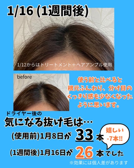 グローターンヘアアンプル/リリーイブ/頭皮ローションを使ったクチコミ(5枚目)
