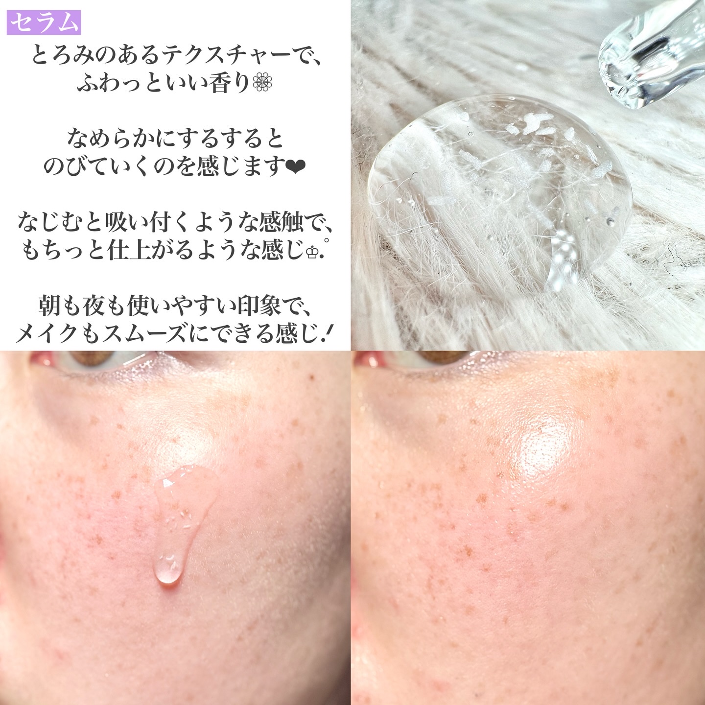 プロバイオダーム™ 3Dリフティング バイオトクシルPLGAセラム/BIOHEAL BOH/美容液を使ったクチコミ（3枚目）