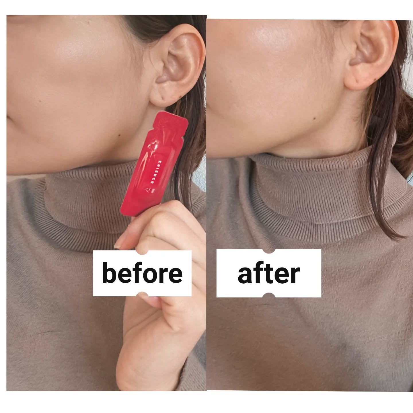 C×AZ ダーマインショット200/ESIENCE/美容液を使ったクチコミ（3枚目）