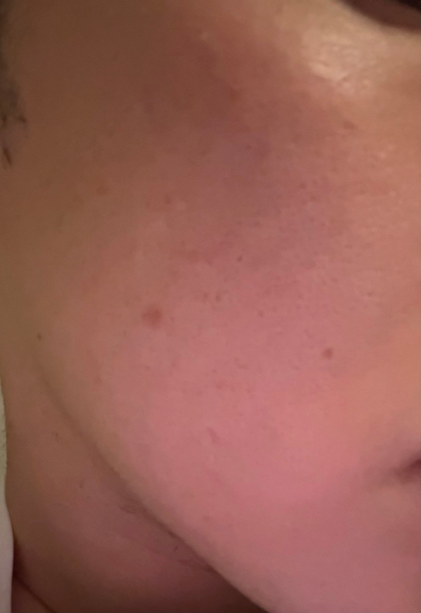 ダーメラ ルミショット・Wビタセラム/Dermela/美容液を使ったクチコミ(4枚目)