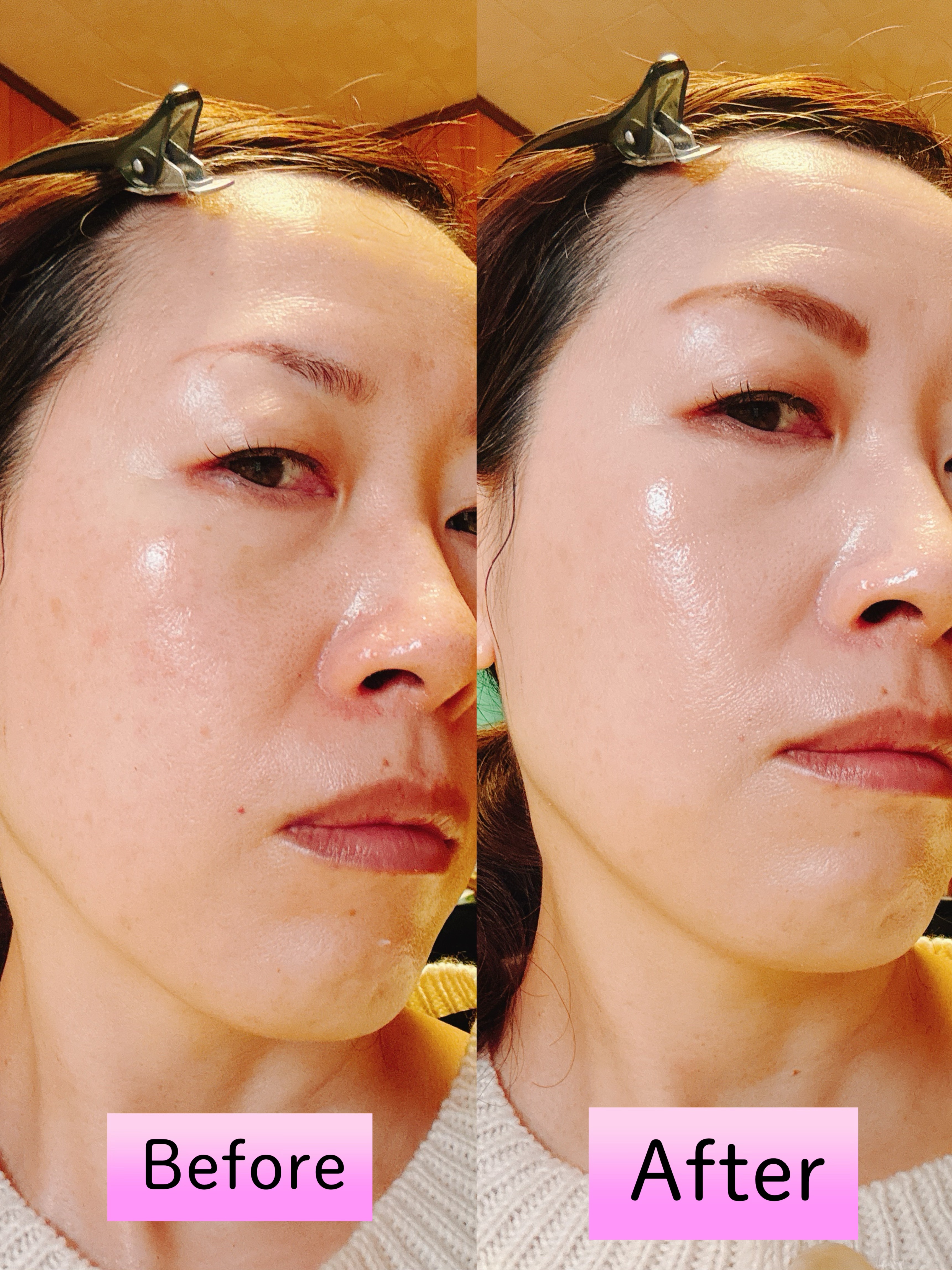 プレステージグロウスキンフィットクッション/VINNE /クッションファンデーションを使ったクチコミ（3枚目）