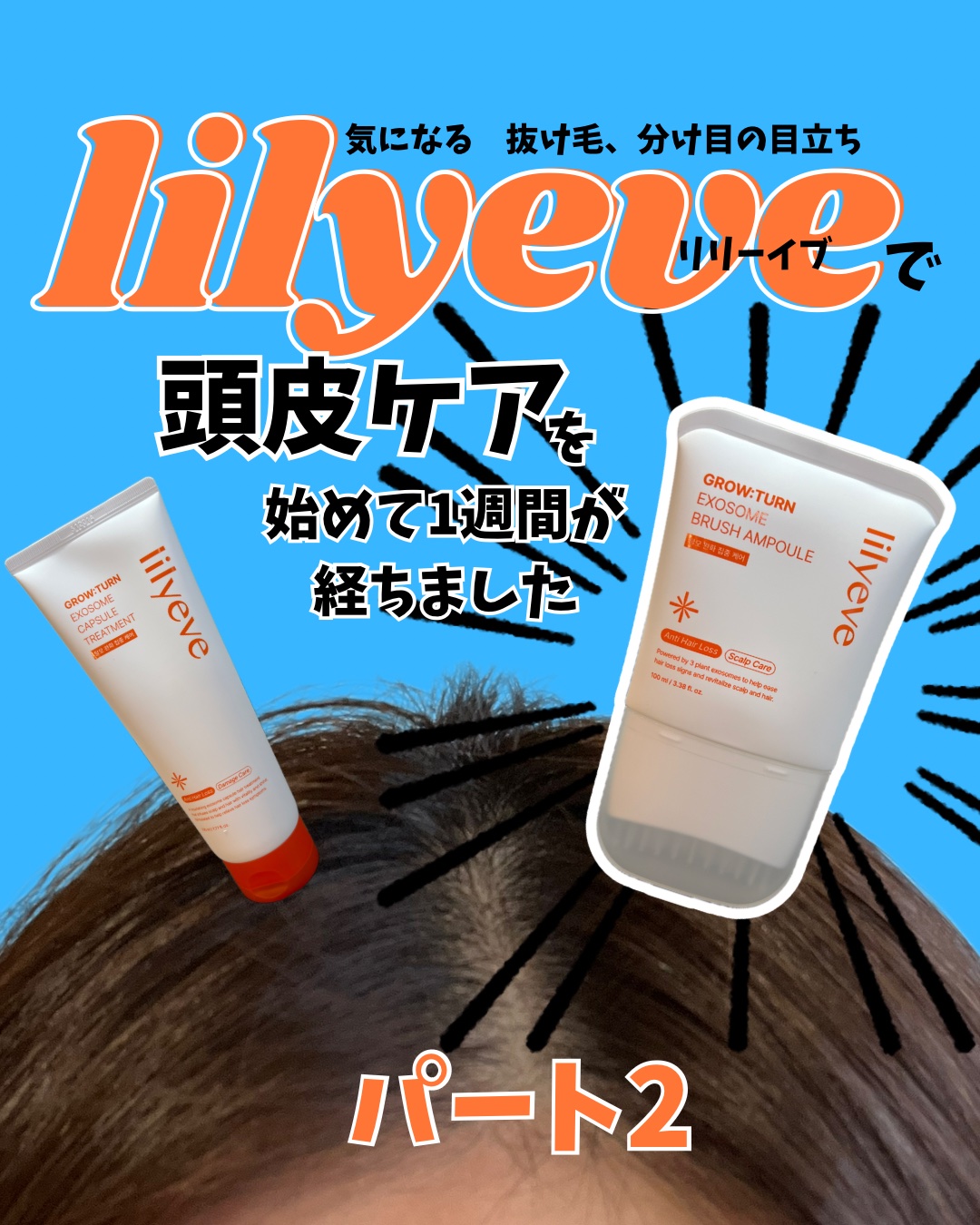 グローターンヘアアンプル/リリーイブ/頭皮ローションを使ったクチコミ（1枚目）