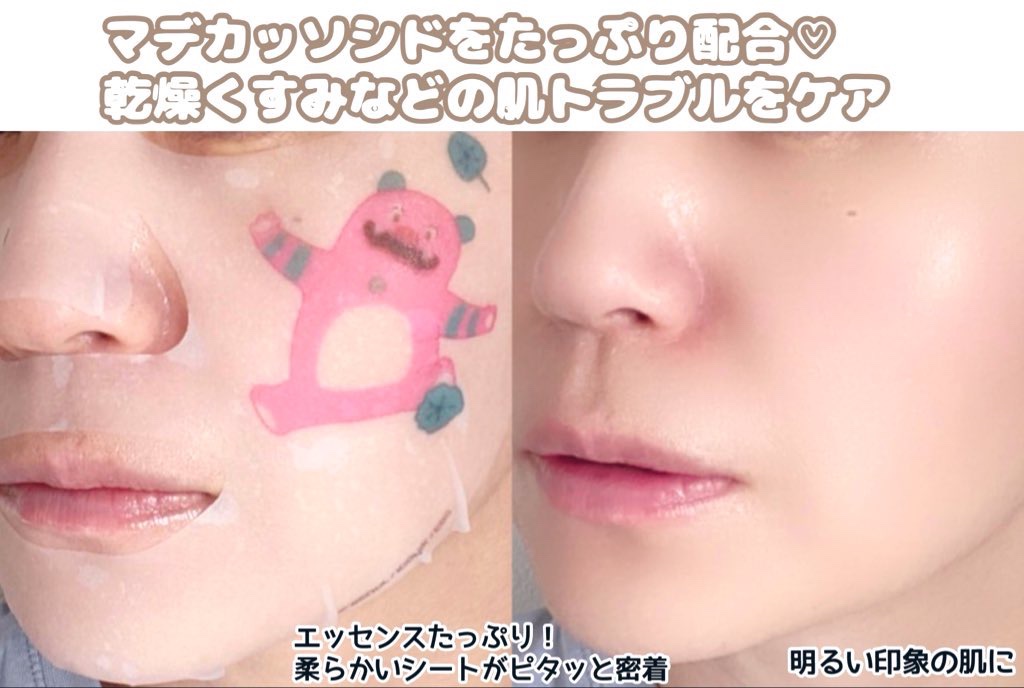 マデカッソシド エッセンシャルマスク/MEDIHEAL/シートマスク・パックを使ったクチコミ（3枚目）