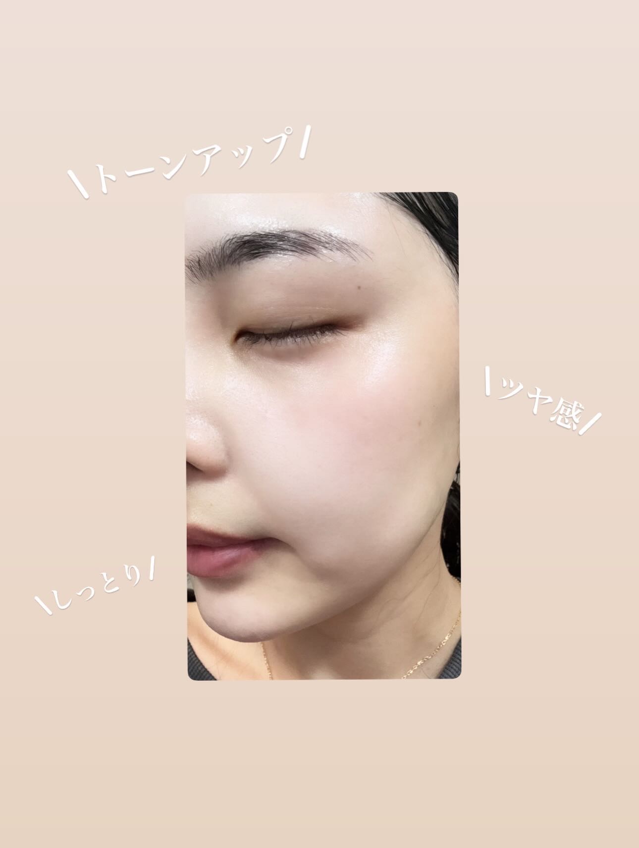 トライアルセット/SKN REMED/トライアルキットを使ったクチコミ（3枚目）