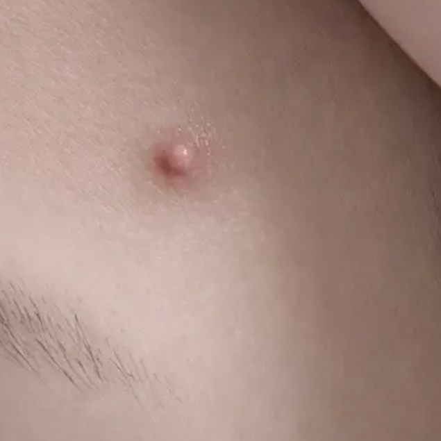 ACマグネシウムパッチ/スノーツープラス/シートマスク・パックを使ったクチコミ（2枚目）