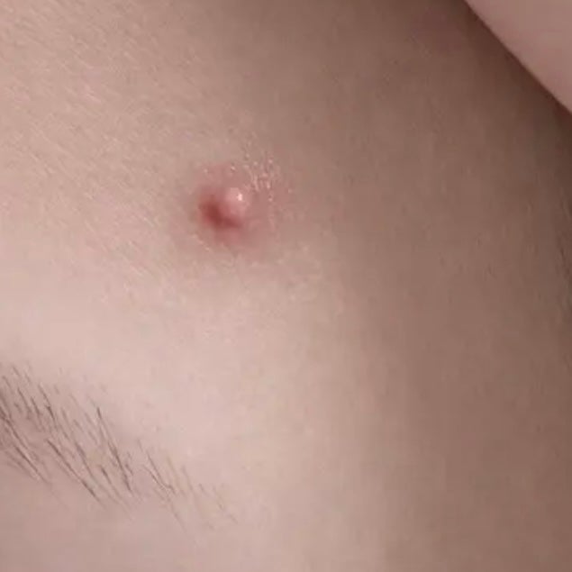 ACマグネシウムパッチ/スノーツープラス/シートマスク・パックを使ったクチコミ(2枚目)