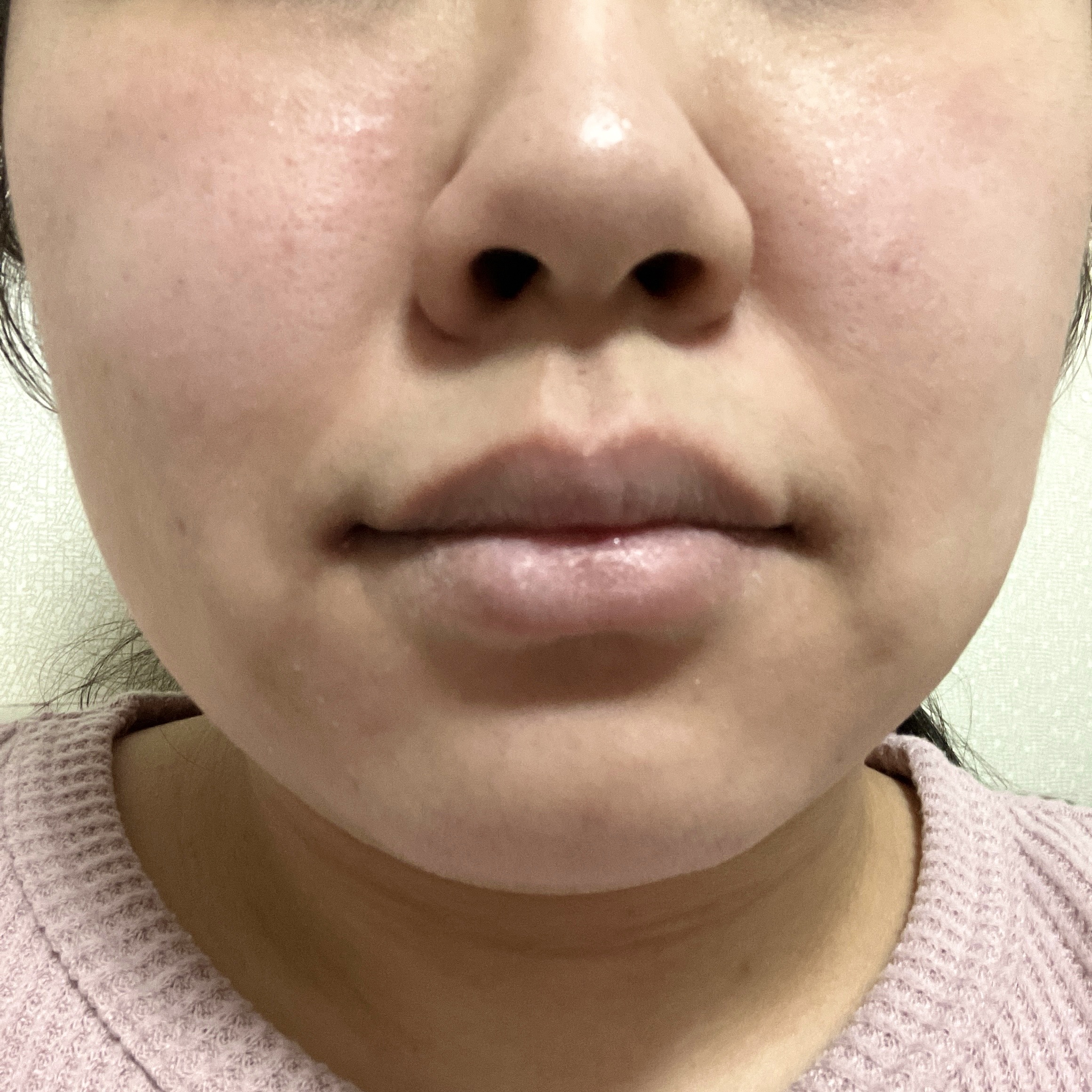 ルルルン ルルルンプレシャス RED（三層保湿）のクチコミ「真冬の乾燥対策として購入した赤のルルルンプレシャスRED MOIST(🟥)

【使った商品】ル.....」（2枚目）