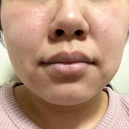 ルルルン ルルルンプレシャス RED(三層保湿)のクチコミ「真冬の乾燥対策として購入した赤のルルルンプレシャスRED MOIST(🟥)
【使った商品】ル.....」(2枚目)