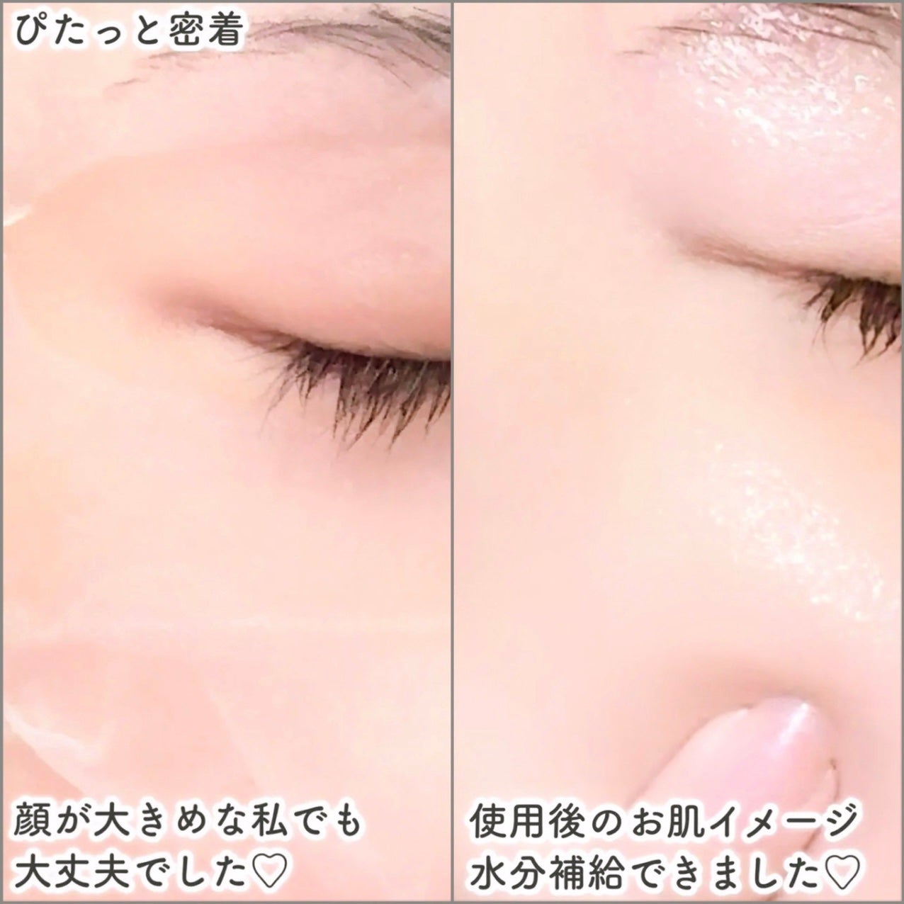 PDRN リフティングマスク/MEDIHEAL/シートマスク・パックを使ったクチコミ(4枚目)