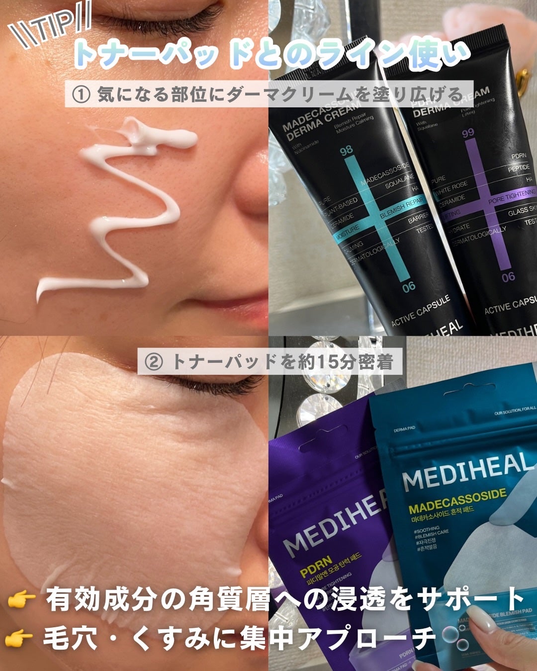 マデカッソシドダーマクリーム/MEDIHEAL/フェイスクリームを使ったクチコミ(5枚目)