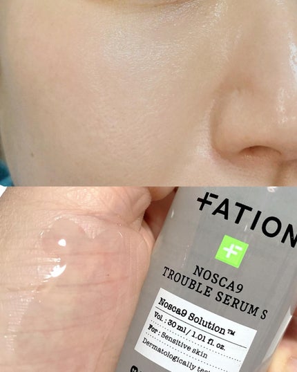 ノスカナイントラブルセラムS/FATION/美容液を使ったクチコミ(3枚目)