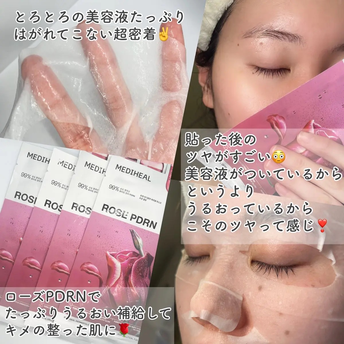 ローゼPDRNエッセンシャルマスクヘルシーグロウ/MEDIHEAL/シートマスク・パックを使ったクチコミ（2枚目）